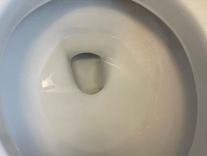 Toilet bowl spotless after stain removal