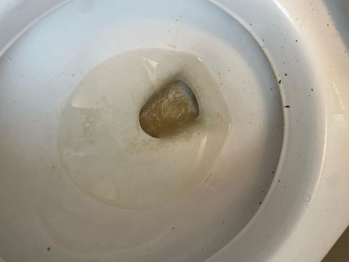 Toilet bowl with heavy stains before treatment